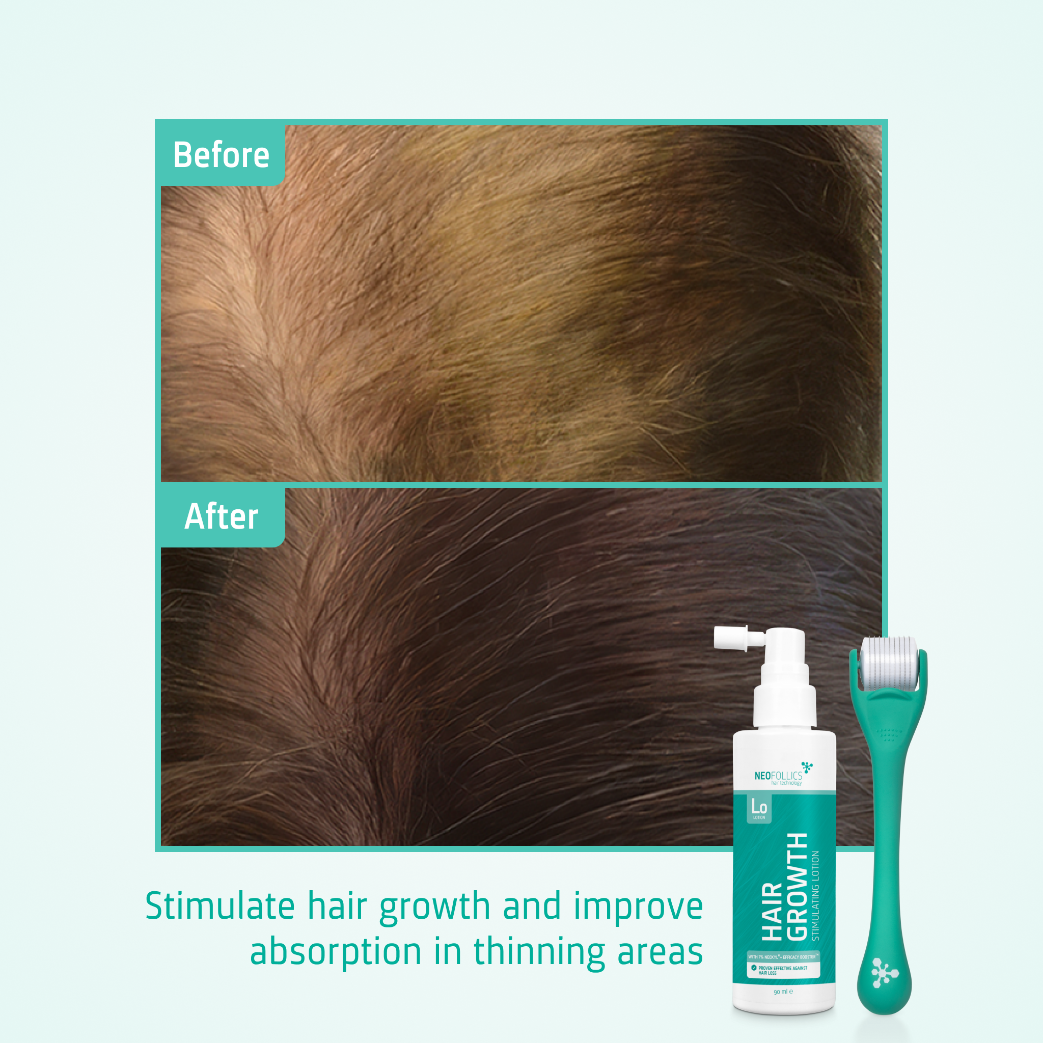 Hair Growth kit before after