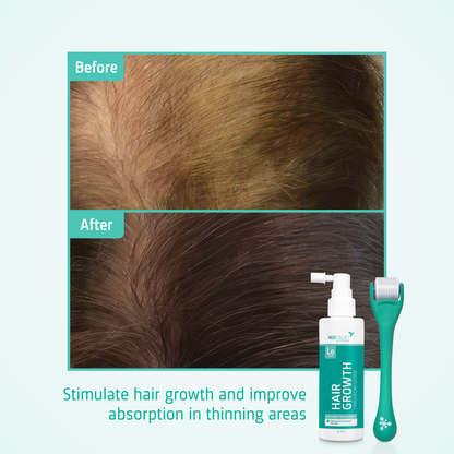 Hair Growth kit before after