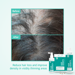 Hair Growth Moderate hair loss routine before after