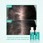 Hair Growth starter kit before after
