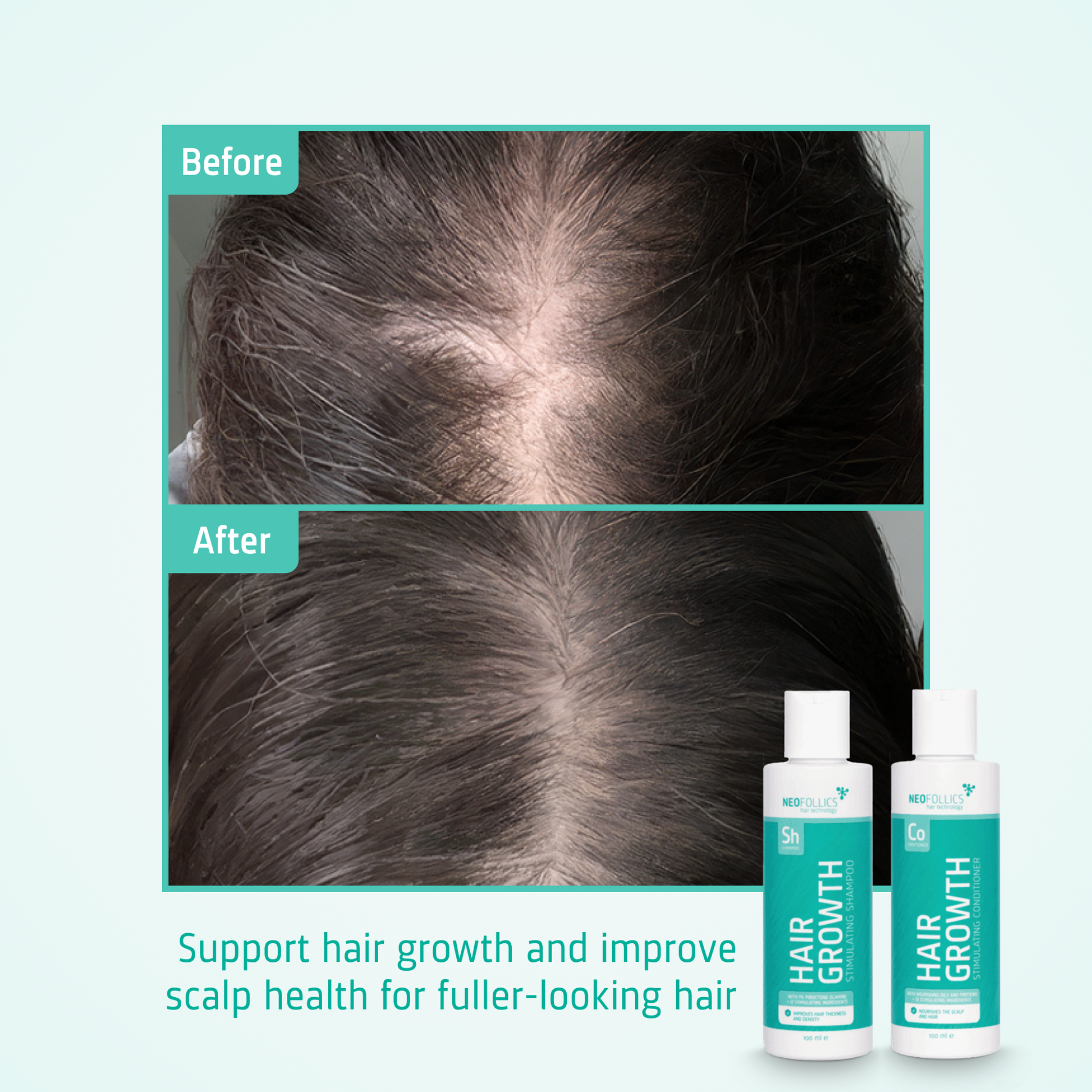 Hair Growth starter kit before after