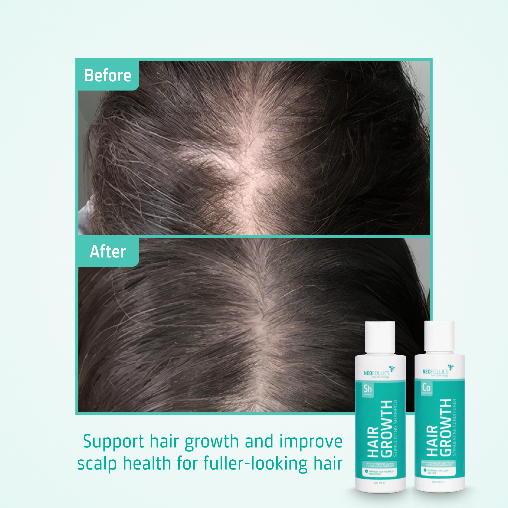 Hair Growth starter kit before after