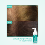 Hair Growth Stimulating Lotion before after