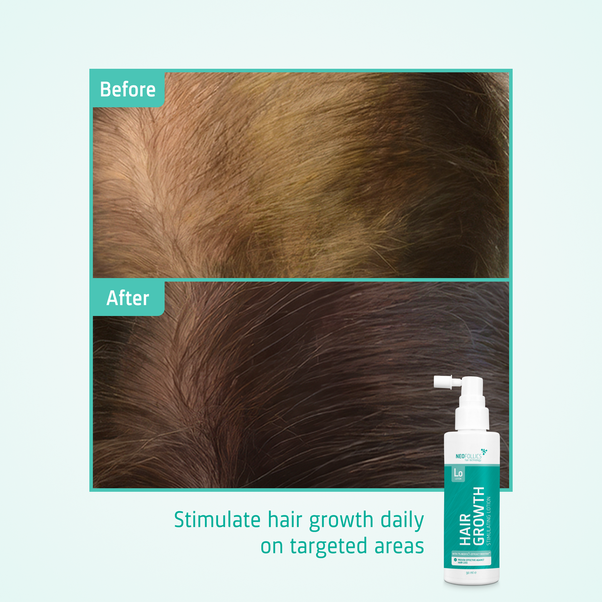 Hair Growth Stimulating Lotion before after