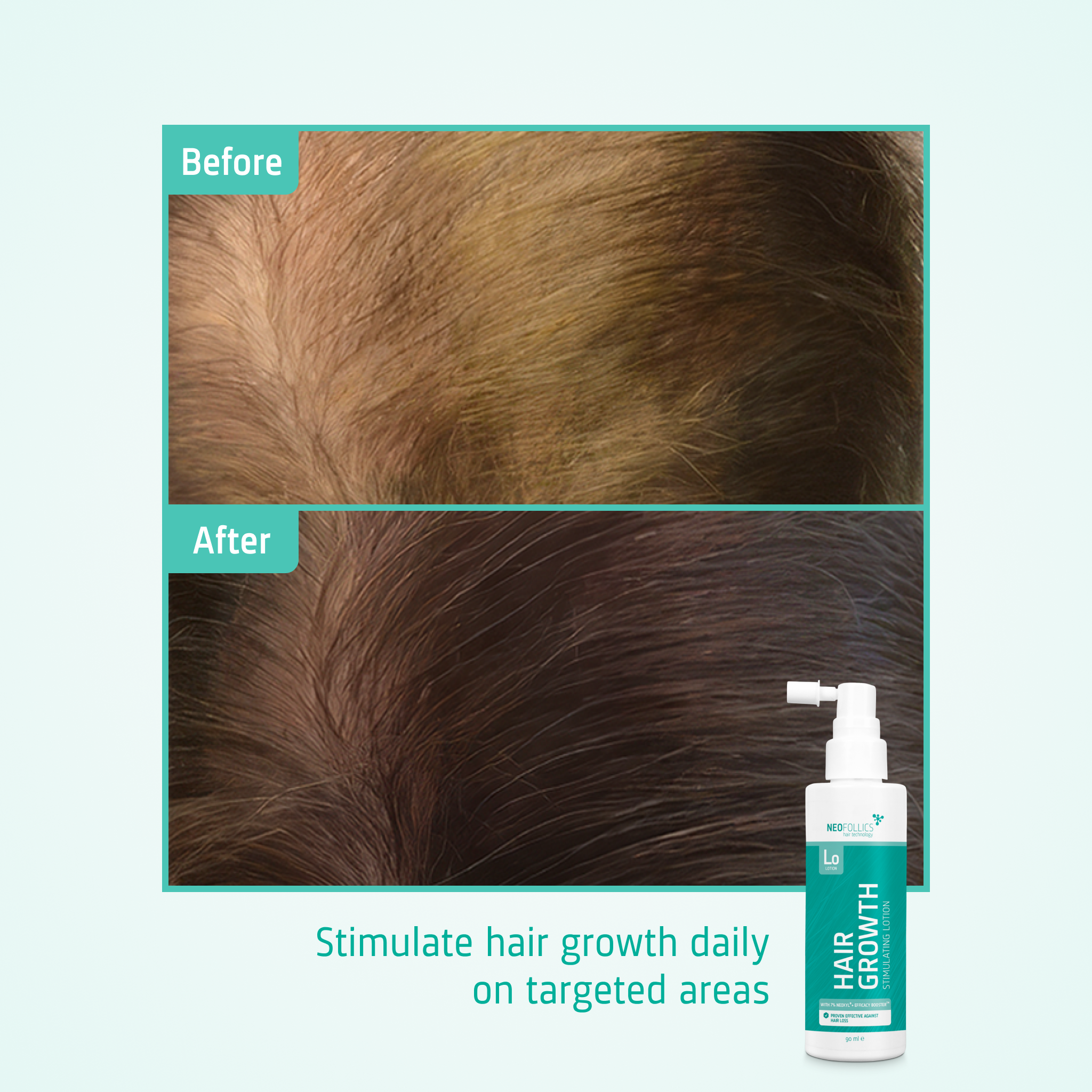 Hair Growth Stimulating Lotion before after