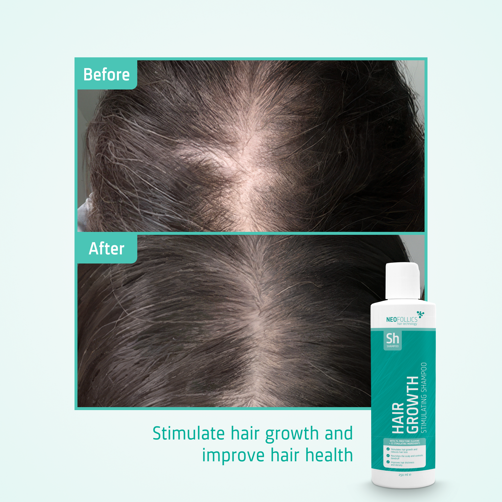 Hair Growth Stimulating Shampoo before after