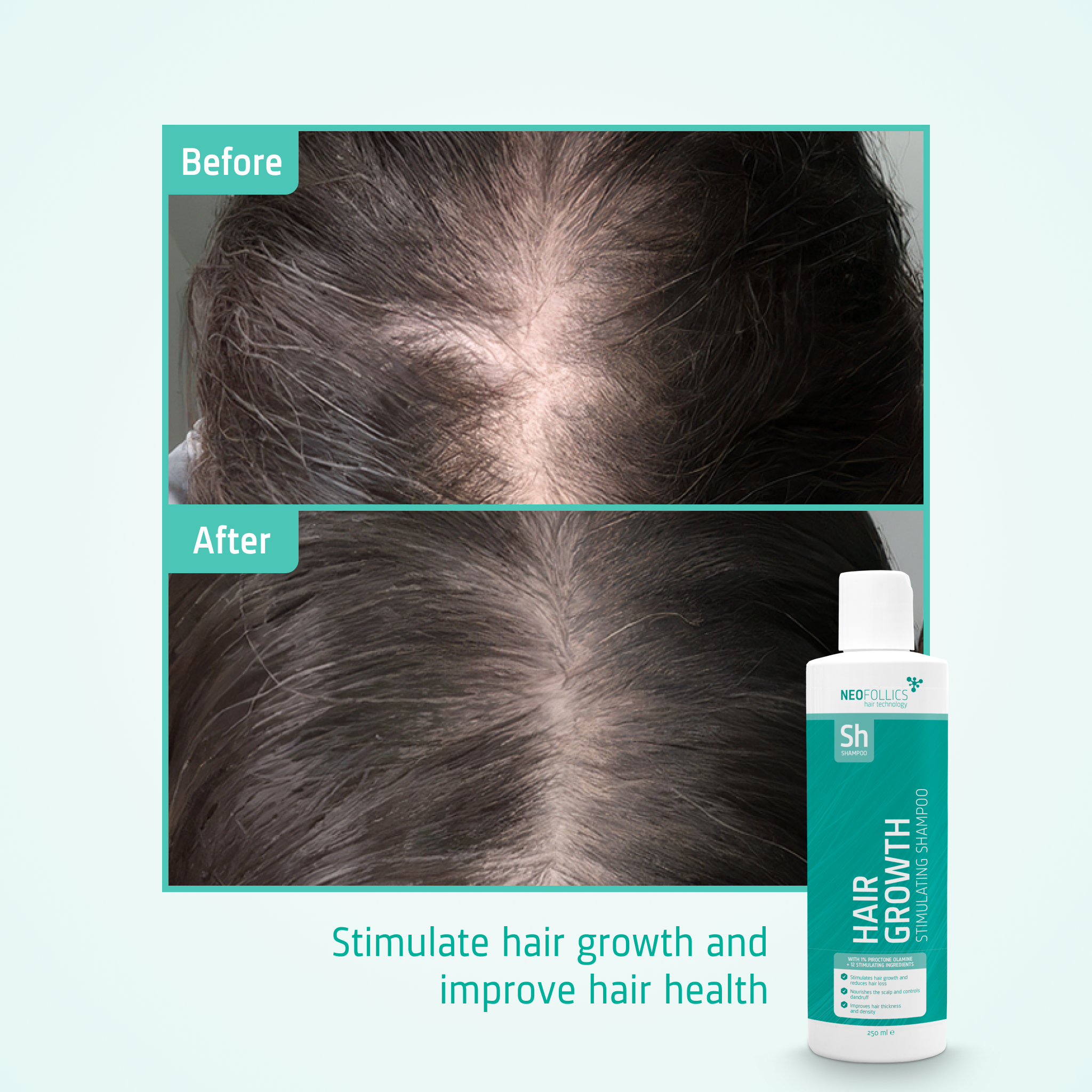 Hair Growth Stimulating Shampoo before after