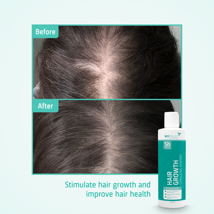 Hair Growth Stimulating Shampoo before after