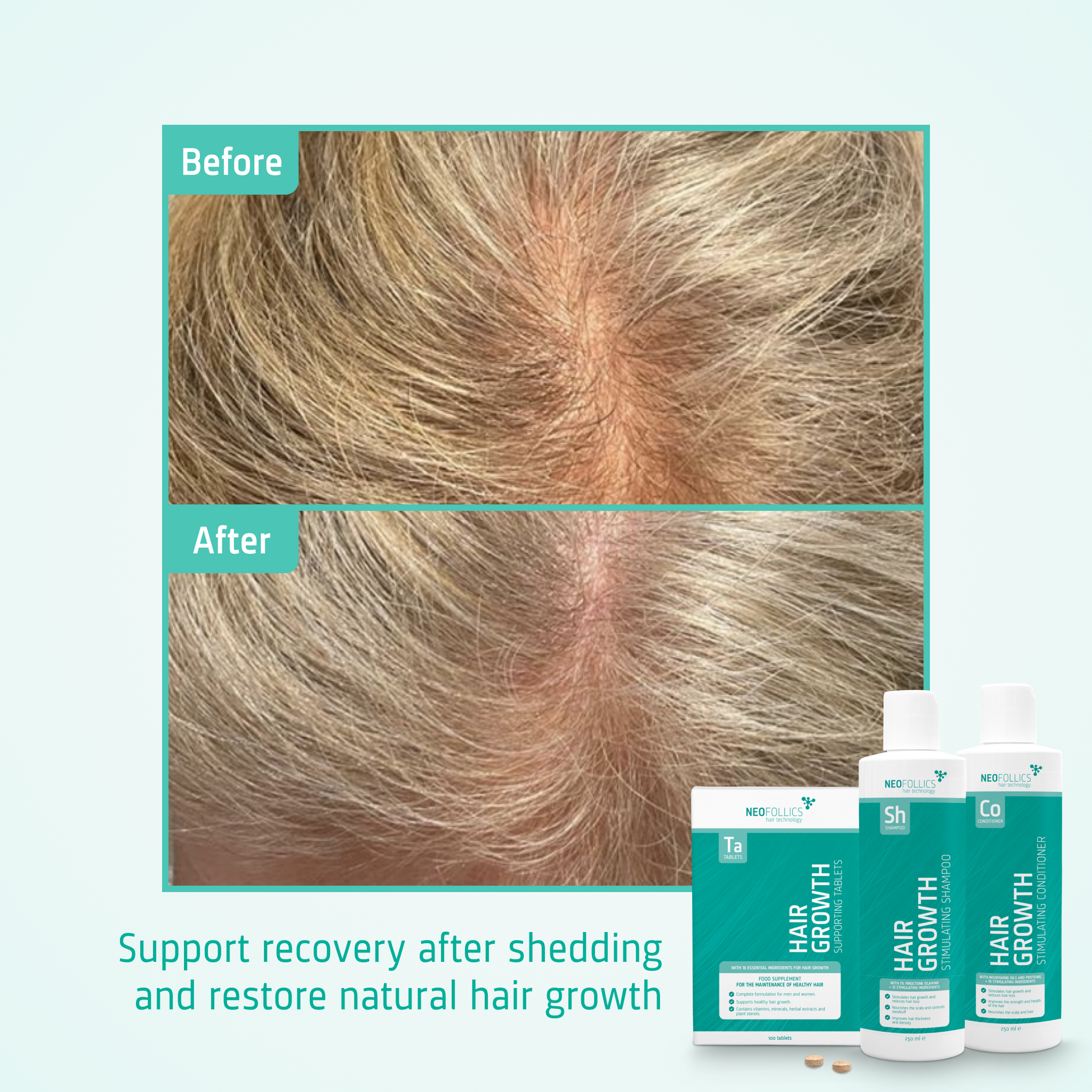 glutathione levels in telegium effluvium How Can Save Your Life Change of total glutathione concentration