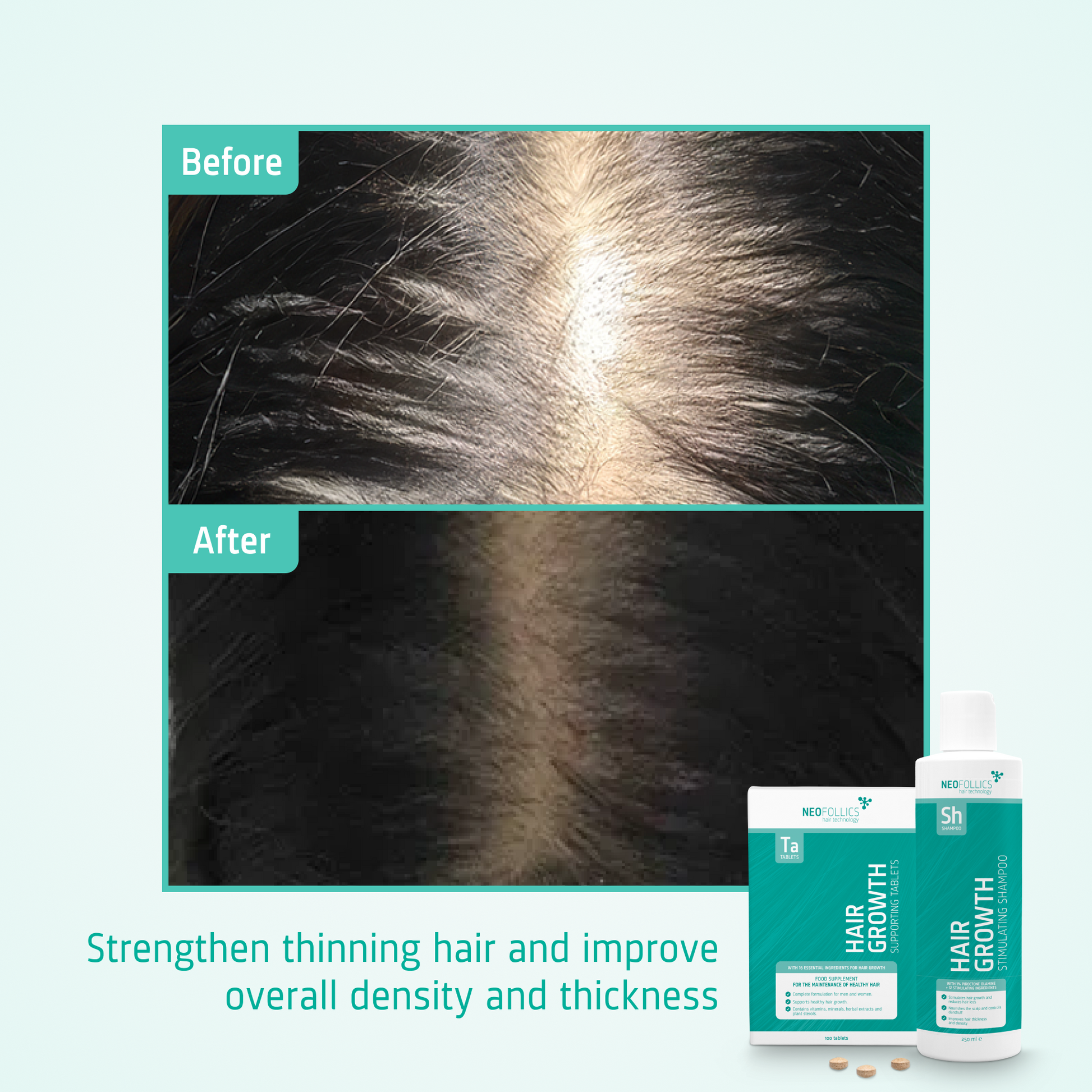 Hair Growth Thinning hair routine before after