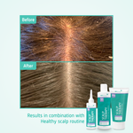 Scalp Massaging Shampoo Brush before after
