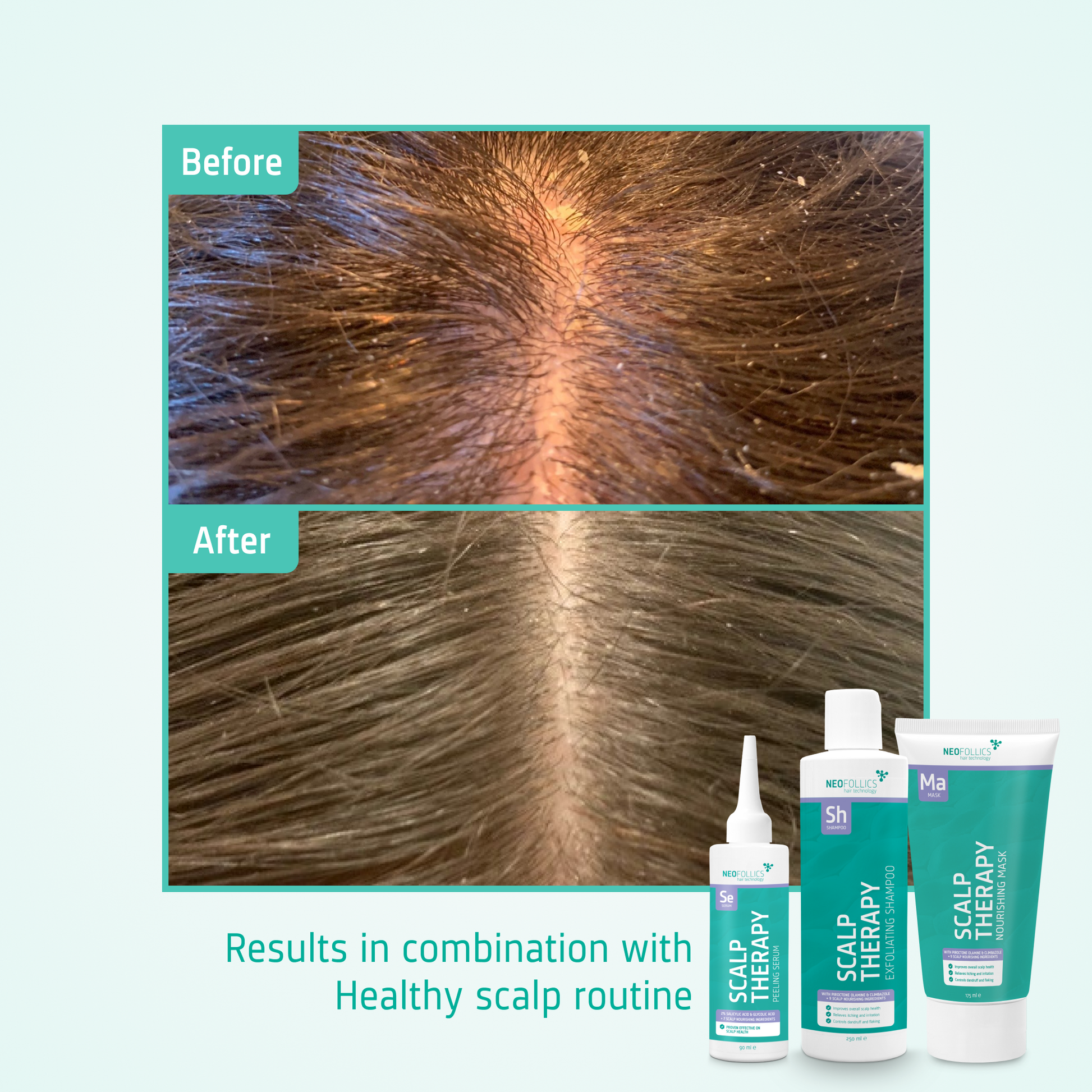 Scalp Massaging Shampoo Brush before after