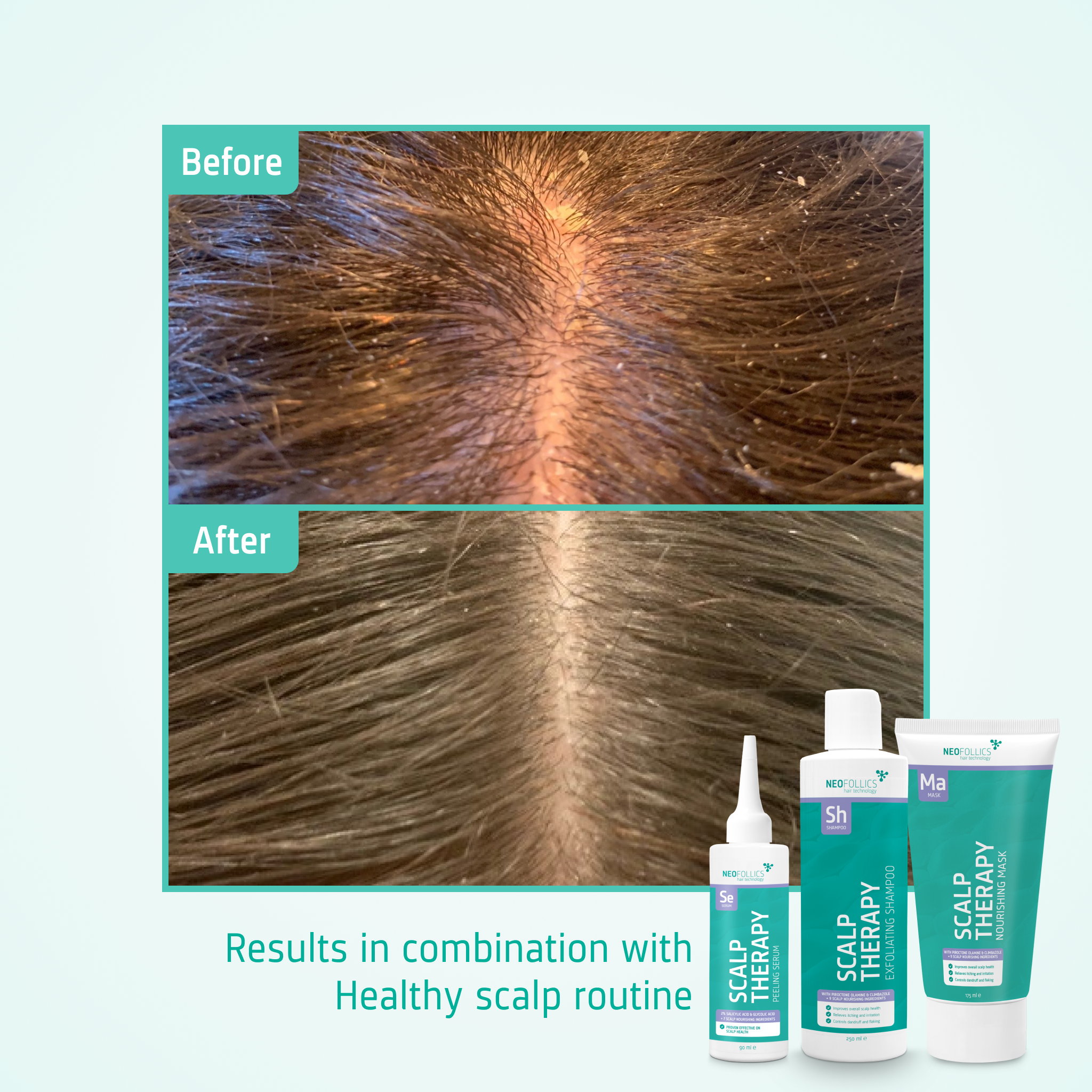 Scalp Massaging Shampoo Brush before after