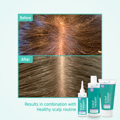 Scalp Massaging Shampoo Brush before after
