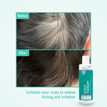 Scalp Therapy Exfoliating Shampoo before after