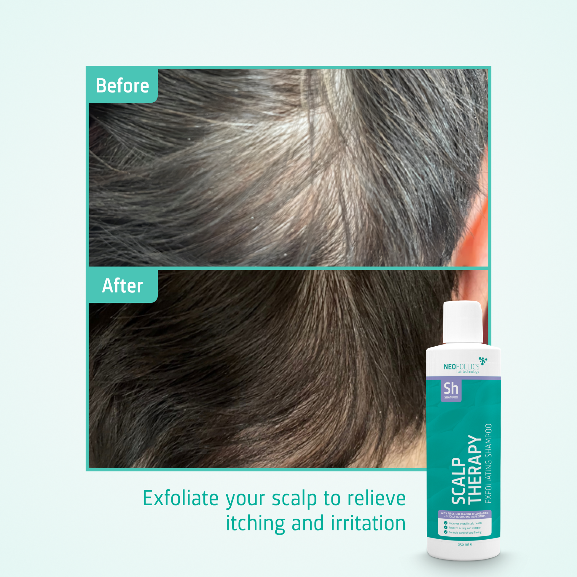 Scalp Therapy Exfoliating Shampoo before after