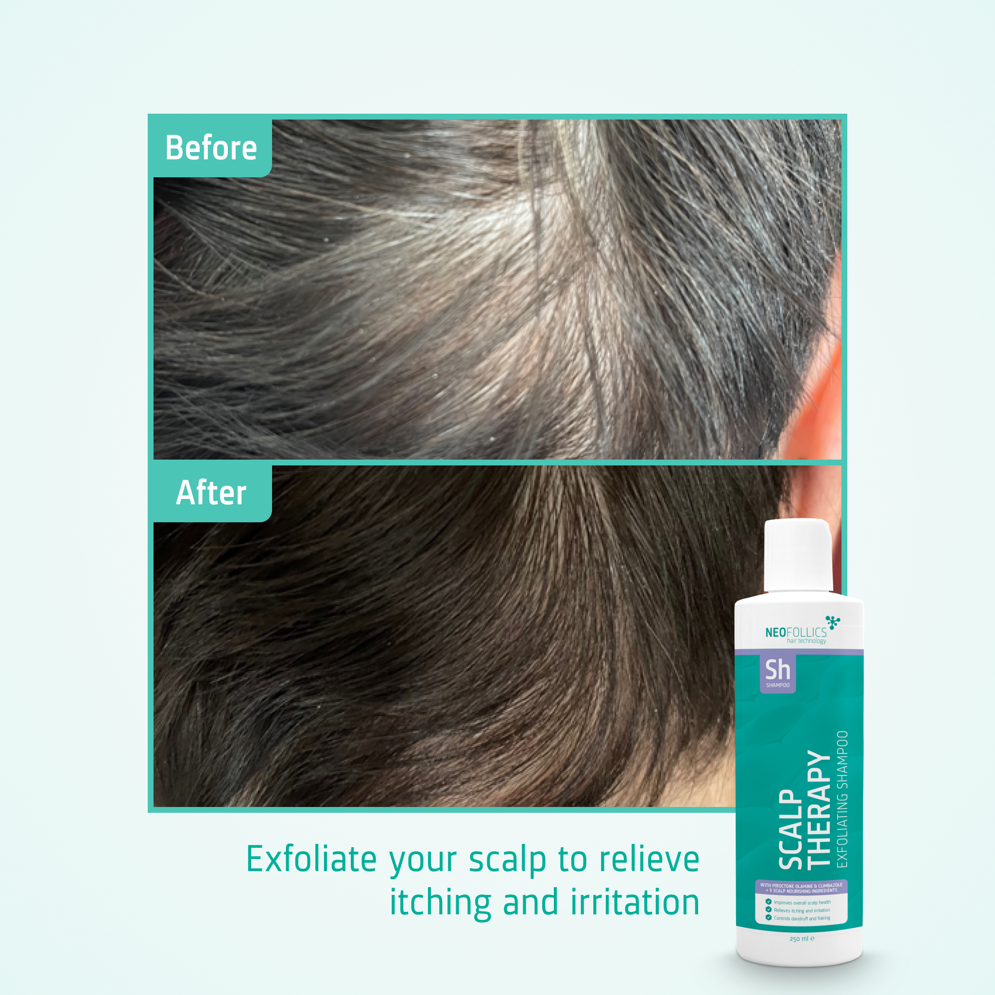 Scalp Therapy Exfoliating Shampoo before after