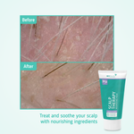 Scalp Therapy Nourishing Mask before after
