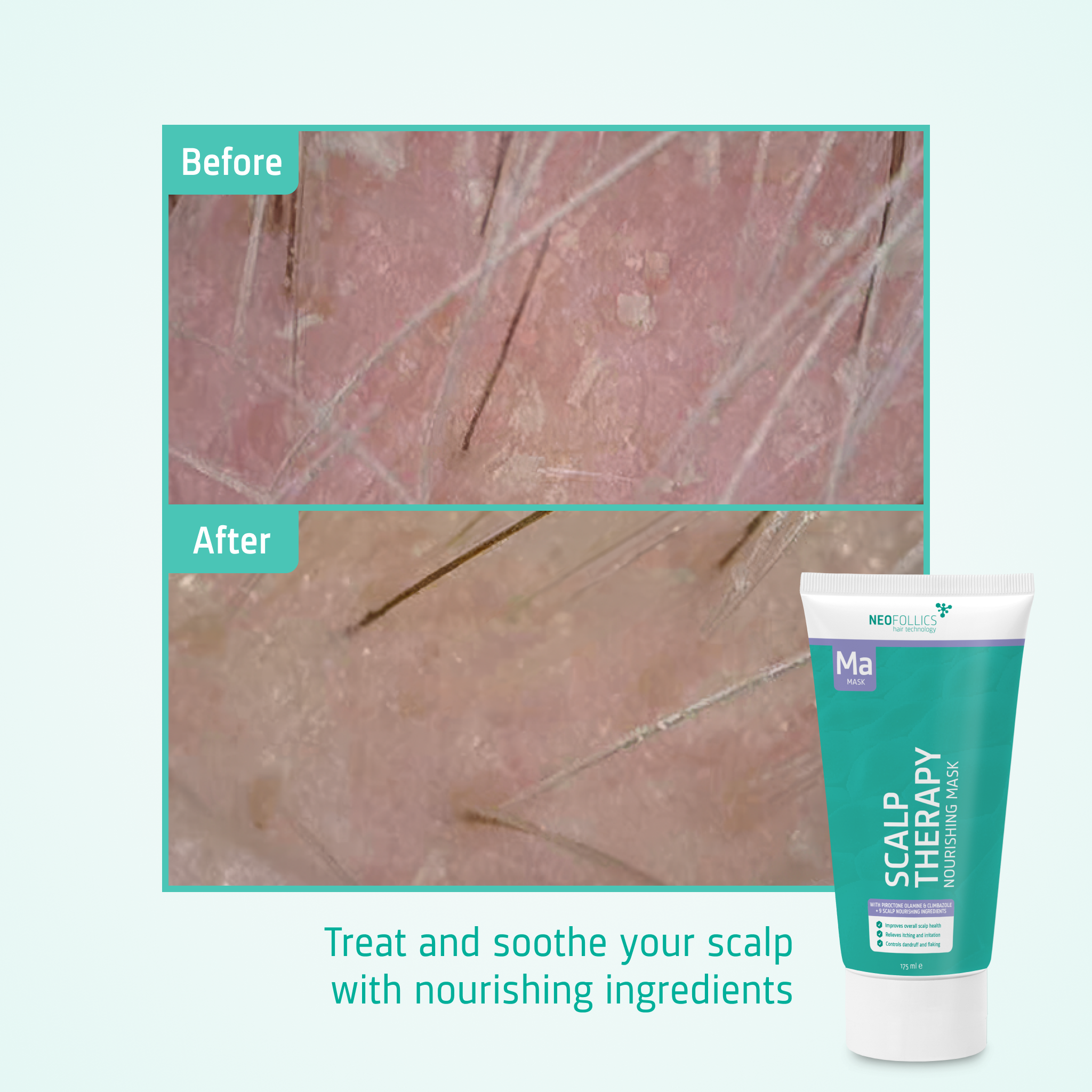 Scalp Therapy Nourishing Mask before after