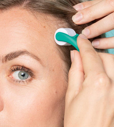 Woman using neofollics dermaroller on scalp close up