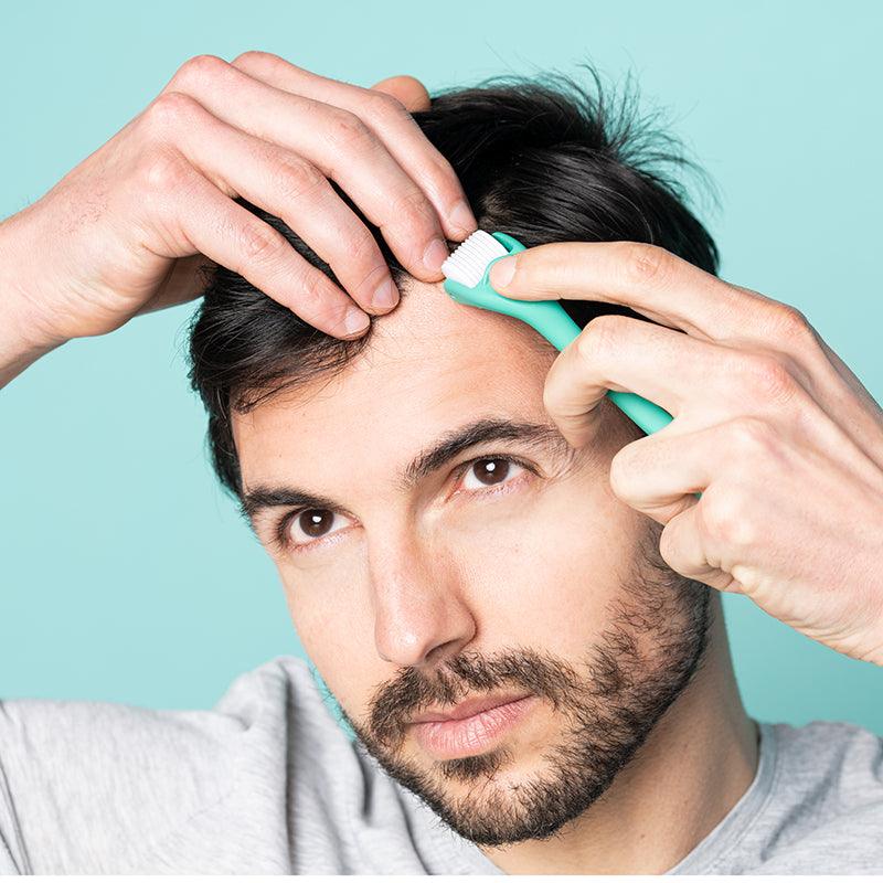 Man rolling neofollics dermaroller on scalp